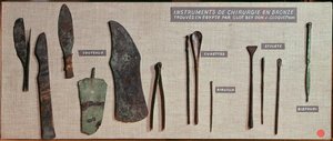 Antoine Barthelemy Clot Beyn (1793-1868) Egyptistä löytämät kirurgiset instrumentit (pronssi).
